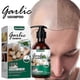 thumbnail image 4 of Jaysuing Garlic Shampoo New |, 4 of 5