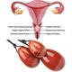 thumbnail image 5 of Rose Quartz Yoni Eggs Set Of 3,massage Stone For Women To Train Pelvic Muscles Kegel Exercise-good, 5 of 5