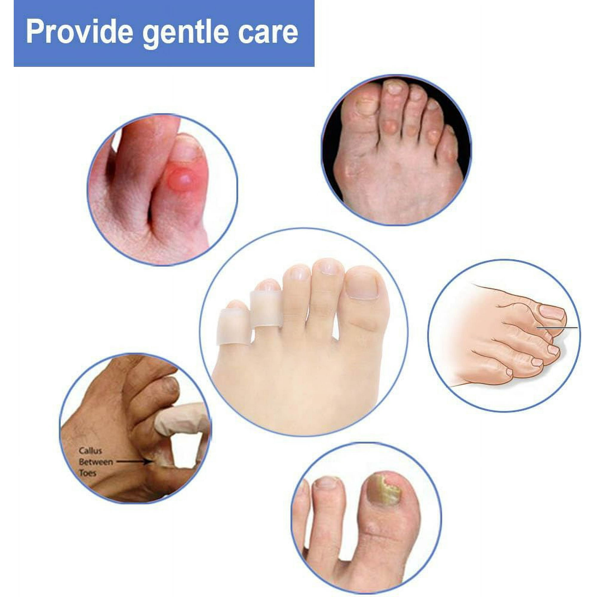 Small Corn On Big Toe Small Corns On Feet New Arrivals