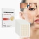 thumbnail image 1 of Parches Para El Acné, Parches Para El Acné, Tratamiento Del Acné, Caída Del Cabello Y Acné, Parches Para El Acné (Buy 2 get 1 free), 1 of 5