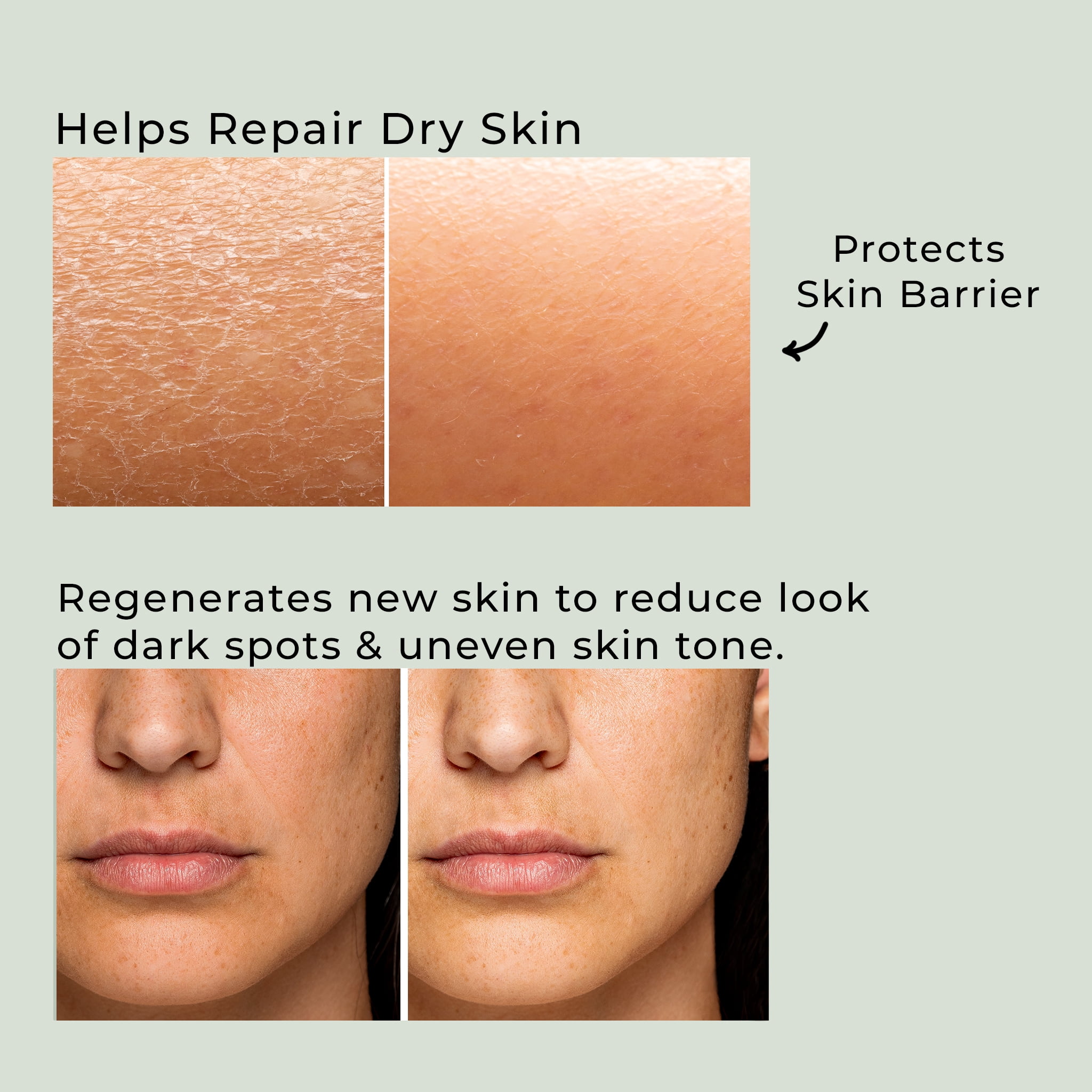 Organic Tamanu Oil | 100% Pure Cold-Pressed , Unrefined | For Face & Body | Deep Hydration