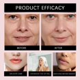 thumbnail image 7 of RAGUPEL 2026 New New Lip Lift Anti Patches, Anti Patches for Lip, Silicone Facial Patches Overnight to Smooth Fine Lines & Wrinkles, Sleeping & Face Patches 6 Pieces, 7 of 7