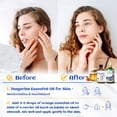 thumbnail image 2 of HIQILI Pure Tangerine Essential Oil, 100mL for Skin & Hair Care, Add to Diffuser Shampoos, 2 of 5