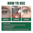 thumbnail image 4 of Eye Drops Relieves Eyes Discomfort Blurred Vision Dry Eyes Itchy Clean Relax Massage Swelling Sore Eye Care, 4 of 4