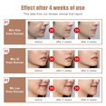 thumbnail image 4 of V-face with LCD Remote Control Sliming Facial Lifting Belt Red Blu-Ray Thin Double Chin and Portable Intelligent Firming Face Slimming Instrument LingWen 9024736131785, 4 of 4