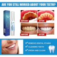 thumbnail image 3 of EELHOE Teeth Cleaning Pen Teeth Whitening Teeth Whitening Oral Care Cr, 3 of 5