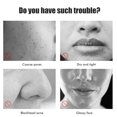 thumbnail image 3 of Cubierta Facial En Barra Cubierta Facial En Barra Cubierta Facial En Barra Hidrata Y Reduce Las Marcas De Acné Limpiador De Barro Cubierta En Barra Cubierta Facial ANGGREK Otros, 3 of 8