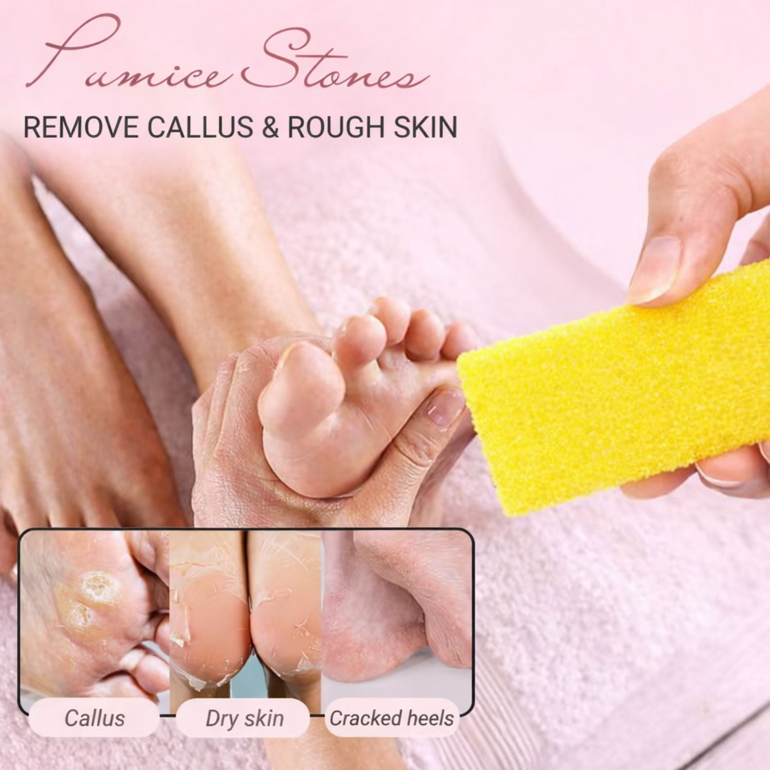 TP Plastic Disposable Foot Scrubber Sponge Pads Pedicure Pumice Stone for Feet Callus Remover Medium Coarse Yellow 1600Pcs