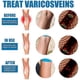 thumbnail image 4 of South Moon Vein Massage Varicose Vena Spray Suaviza las protuberancias de las venas Suaviza las piernas de lombriz de tierra Masaje de piernas Aceite de masaje 1 pieza) -GSL | |, 4 of 5