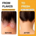 thumbnail image 5 of Pharmlitalia Psoriasis Shampoo for Dry & Itchy Scalp with Salicylic Acid 3% - Psoriasis Scalp Treatment for Eczema Relief, Seborrheic Dermatitis, Ringworm & Folliculitis (6.76 Fl Oz (Pack of 2)), 5 of 7