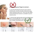thumbnail image 3 of Kit extractor de puntos negros YOUYISI de 22 piezas, 3 of 7