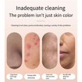 thumbnail image 4 of Electric Blackhead Remover Face Pimple Extraction Facial Cleanser, 4 of 5