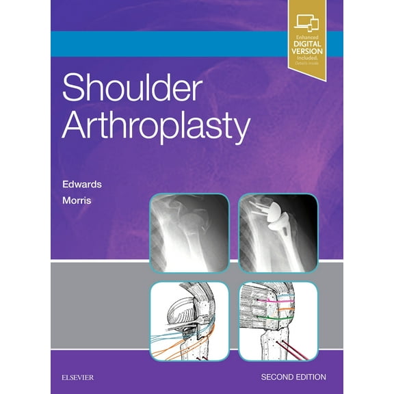 Shoulder Arthroplasty