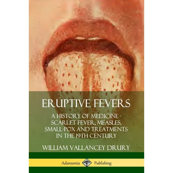 Eruptive Fevers: A History of Medicine - Scarlet Fever, Measles, Small-Pox and Treatments in the 19th Century, (Paperback)