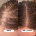 thumbnail image 3 of BondiBoost HG Anti-Thinning Shampoo Conditioner Set [16.90 fl oz each], Clinically Tested to Promote Fuller + Thicker-Looking Hair for Women & Men, Procapil, Redensyl & Rosemary Formula, Sulfate-Free, 3 of 4