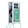 thumbnail image 2 of Funda FOXDOCK para Xiaomi 14T con Cuerda Ajustable, Brillo Líquido, Protección Antigolpes y Lente – Ideal para Regalo, 2 of 6