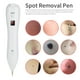 thumbnail image 1 of Pluma de eliminación de lunares, pluma de eliminación de manchas de topo recargable por USB, removedor de pecas diseñado para profesionales, 1 of 8
