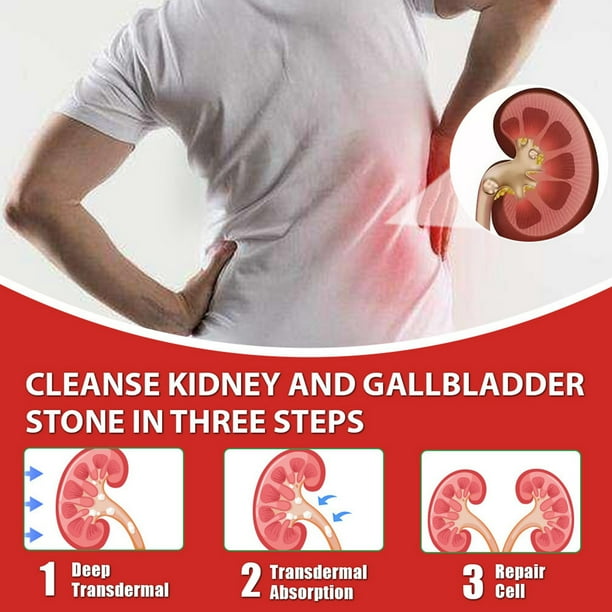 Kidney 2024 stone cleanse