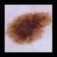 thumbnail image 4 of Microscopio DermatoscóPico PortáTil de Completo 10X Microscopio de Equipo para DermatóLogos Microscopio DermatoscóPico, 4 of 5