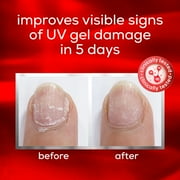 Essie Nail Care, to the Rescue UV Gel Damage Repair Nail Protector, 0.46 fl oz