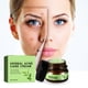 thumbnail image 4 of Acné A Base De Hierbas, Hierbas Para El Acné, Cuidado De La Piel Facial, Acné Hidratante, Extractos De Plantas Para Eliminar El Acné Facial, Hidratante Para Encoger,30ML, 4 of 9