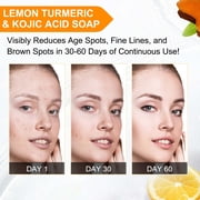 Ikzee Lemon Turmeric Kojic Acid Soap, Natural ingredients, Gentle cleansing, Clean Skin, with Foam Mesh Bags, 100g