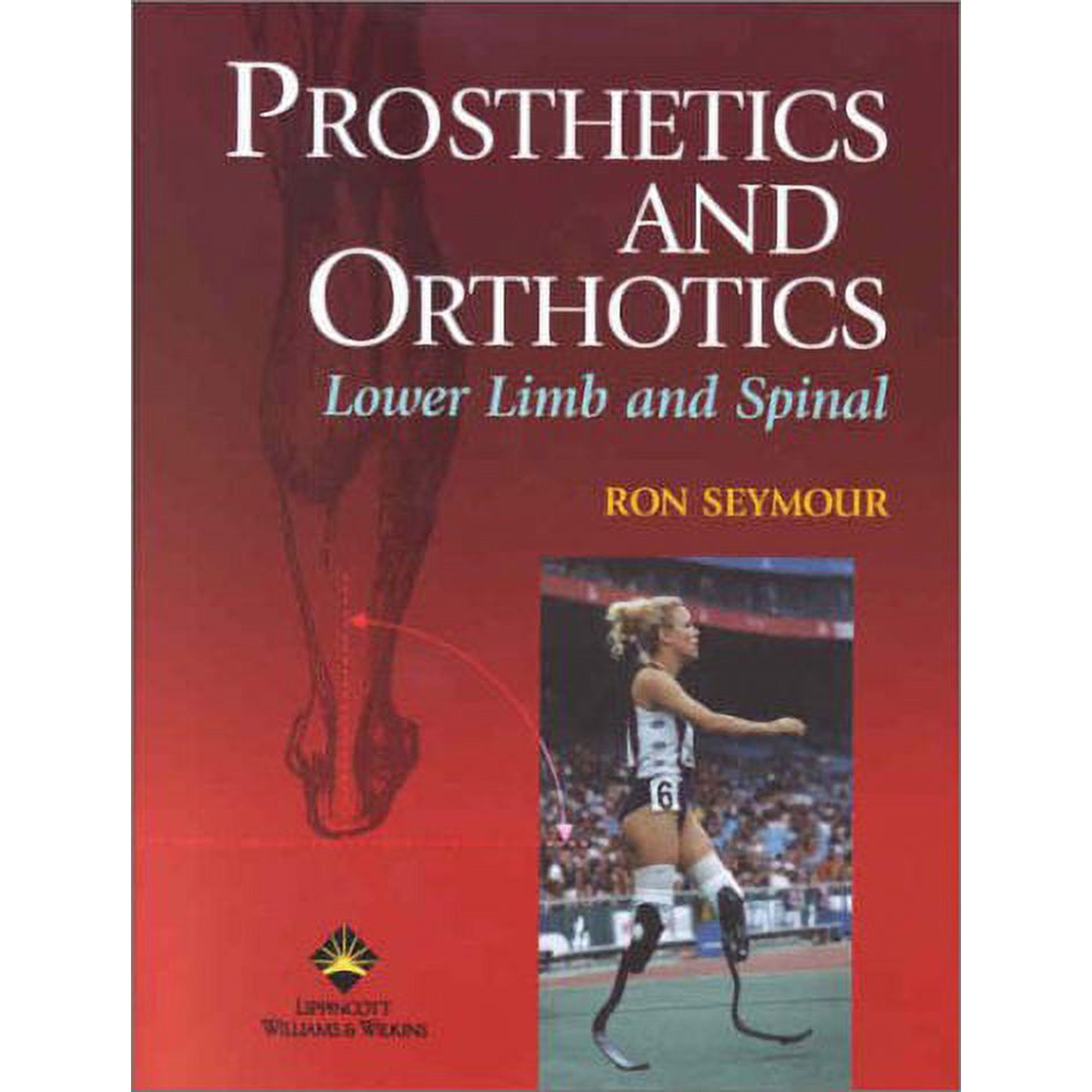 Prosthetics and Orthotics: Lower Limb and Spinal (Hardcover) by Ron Seymour