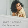 thumbnail image 5 of Neutrogena Rapid Clear, 5% Benzoyl Peroxide, Maximum Strength Acne Spot Treatment Gel, 5 of 5