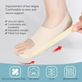 thumbnail image 3 of Correcteur d'Oignon avec Distribution de Pression, Trou de Décompression, Force Réglable, Fixation Sécurisée, Tissu Confortable pour Hallux Valgus, 3 of 7
