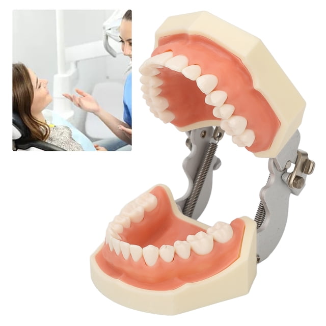 Modelo De Preparación De Dientes, 28 Dientes Modelo De Dientes De Quiste De Resina Desmontable Enseñanza De Fijación De Tornillos Para Exámenes De Certificación Para