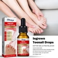 thumbnail image 3 of 4 piezas 10 ml South Moon Ingrown Toenail Repair Serum Nail Care Aceite esencial Reparación Limpieza para eliminar la onicomicosis, 3 of 5