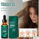 thumbnail image 5 of Xihbxyly Aceite para La Foliculitis Del Cuero Cabelludo, Aceite Nutritivo Natural para El Cuero Cabelludo, Aceite para Aliviar La Sequedad Del Cuero Cabelludo, Promueve El Crecimiento Del Cabello y A, 5 of 7