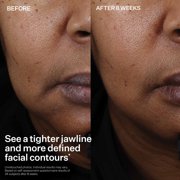 StriVectin Peptight Face Lift Serum, 1 fl oz