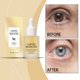 thumbnail image 4 of Sérum contorno de ojos con cafeína 30ml para ojeras, hinchazón, hinchazón, ojos cansados | Potenciador de ojos instantáneo con té verde y granada | Fórmula vegana hidratante tensora | Piel sensible, 4 of 8