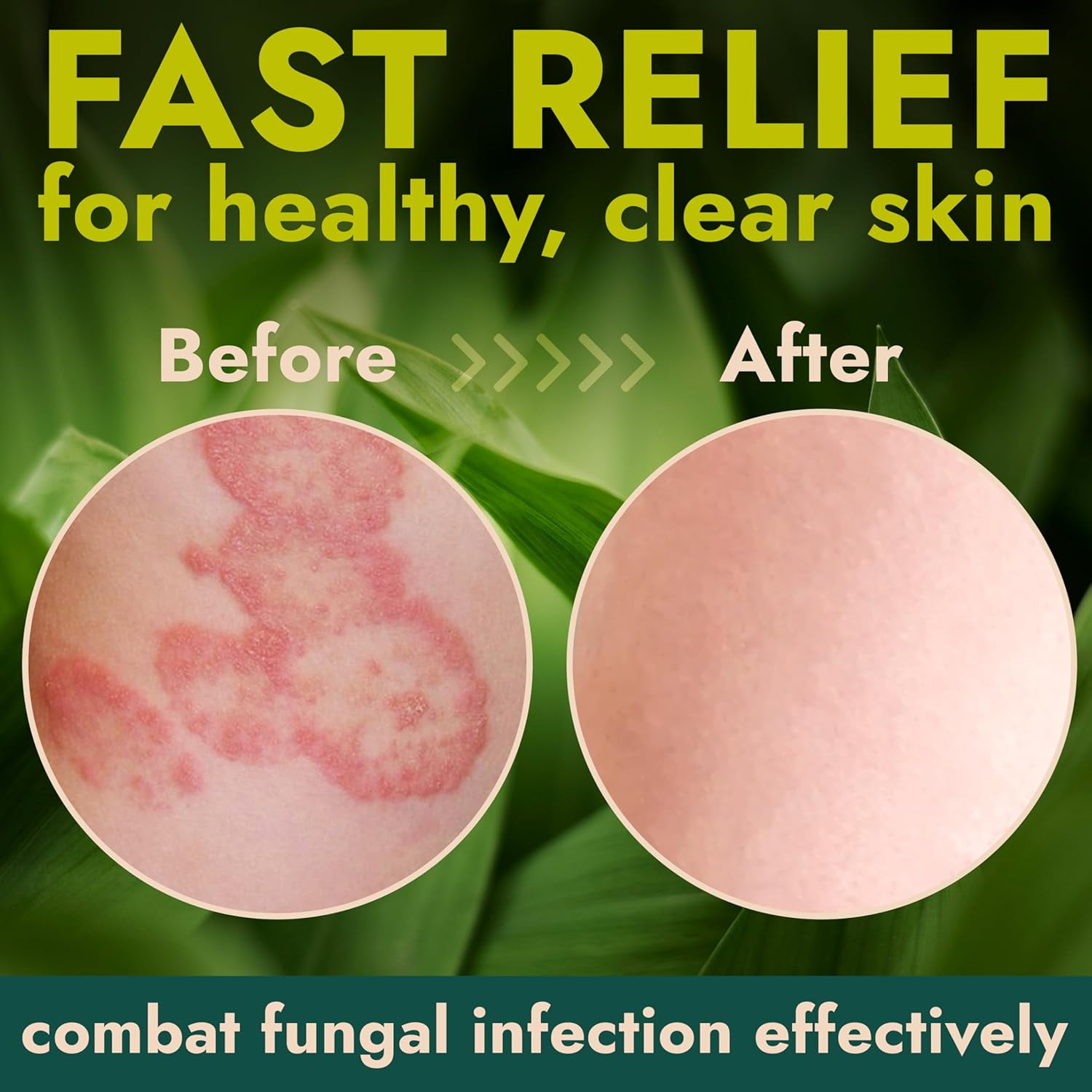 Antibacterial Body Lotion Antifungal Cream | Kills 99.9% of Germs and Bacteria | Helps Sanitize Skin | Infused with Botanical Extracts