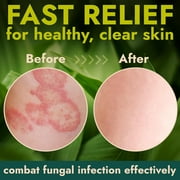 Antibacterial Body Lotion Antifungal Cream | Kills 99.9% of Germs and Bacteria | Helps Sanitize Skin | Infused with Botanical Extracts