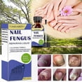 thumbnail image 5 of Effective Nail Fungus Treatment - 30ml Antifungal Solution for Stronger, Healthier Nails, 5 of 5