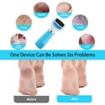 thumbnail image 3 of Electric Foot File Callus Remover - Foot Scrub Pedicure Kit, 3 of 5