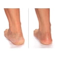 thumbnail image 2 of Crema para pies Advanced Clinicals Cracked Heel, paquete de 2, 2 of 7