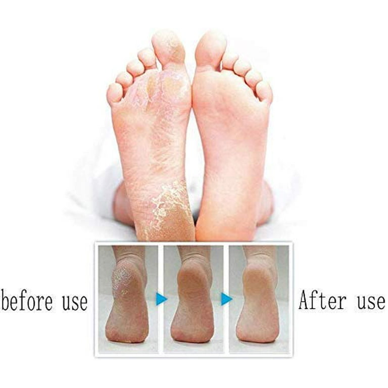 Dull Polish Foot Care Tool Heads Hard Skin Remover Refills