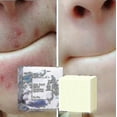 thumbnail image 3 of Jabón antihongos para la piel, jabón antiácaros, jabón hecho a mano, jabón de sal marina, antiácaros, control de aceite y reafirmante Sk, 3 of 5