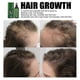 thumbnail image 3 of Jaysuing Hair Dense Hair Liquid Strong And Tough Hair Nourishing Hair Root Growth Thick Scalp Massage Nutrient Solution - 30Ml, 3 of 4