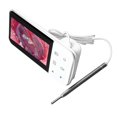 thumbnail image 4 of Digital Otoscope Visual Comfortable Ear Camera Earpick Ear Wax Removal Tool with 4.5in Display, 4 of 5