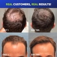 thumbnail image 2 of Hair Growth Shampoo for Men - Biotin Thickening Shampoo with Rosemary Tea Tree Oil Caffeine for Hair Loss and Thinning Hair - 13.5 Fl Oz (Pack of 1), 2 of 9