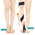 thumbnail image 3 of Jesscasday O/X Leg Type Leg Correction Bands Leg Postures Corrector Legs Straightener Belt, 3 of 18