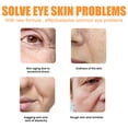 thumbnail image 3 of Mascara Para Los Ojos 2 uds antiarrugas máscara de ojos 10g colágeno proteína ojos cosméticos para todo tipo de piel Sywqhk Cuidado Belleza, 3 of 6