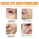 thumbnail image 4 of 2 uds antiarrugas máscara de ojos 10g colágeno proteína ojos cosméticos para todo tipo de piel Ygjytge Cuidado Belleza, 4 of 7