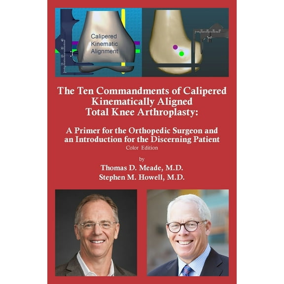 The Ten Commandments of Calipered Kinematically Aligned Total Knee Arthroplasty, (Paperback)