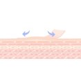 thumbnail image 4 of Bangcool Scar Sheets Waterproof Adhesive: 6PCS Reusable Soft Scar Patches Scar Gel Strips, 4 of 10