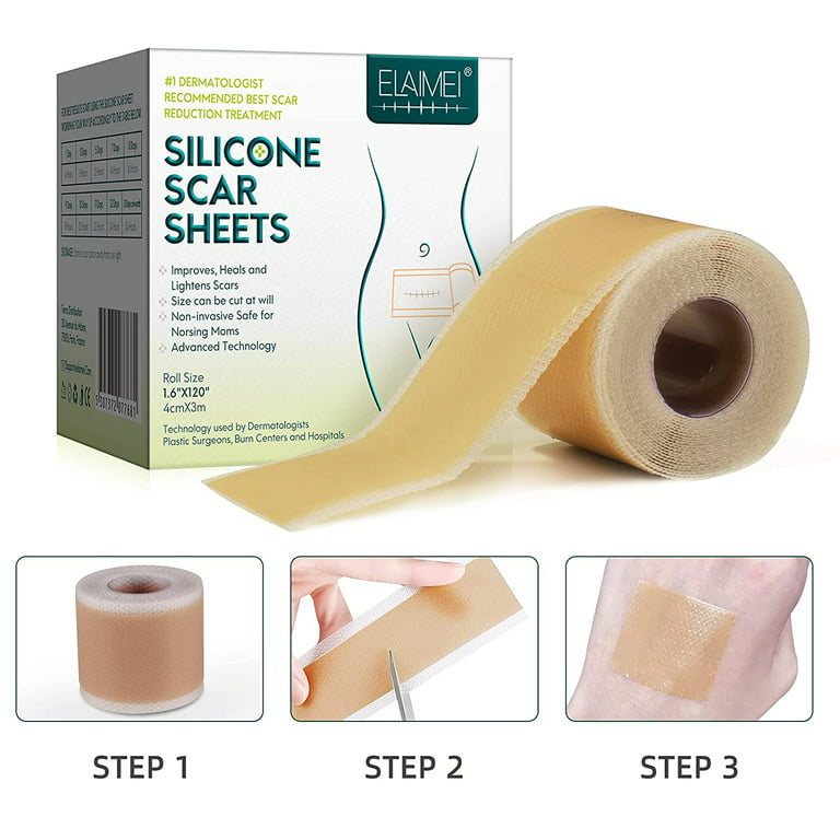 Silicone Scar Sheets (1.6” x 120” Roll-3M), Scar Silicone Strips, Reusable,  Professional Scar Removal Sheets 